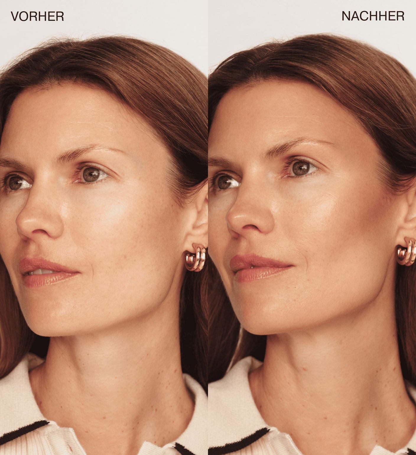 All-in-One Bundle mit The Soft Tan Bronzer Vorher-Nachher-Vergleich, der einen natürlichen Sommer-Glow zeigt