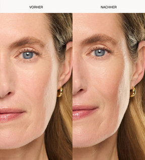 Daily Face SPF 40 Vorher-Nachher-Vergleich zeigt einen hydratisierten und strahlenden Teint.
